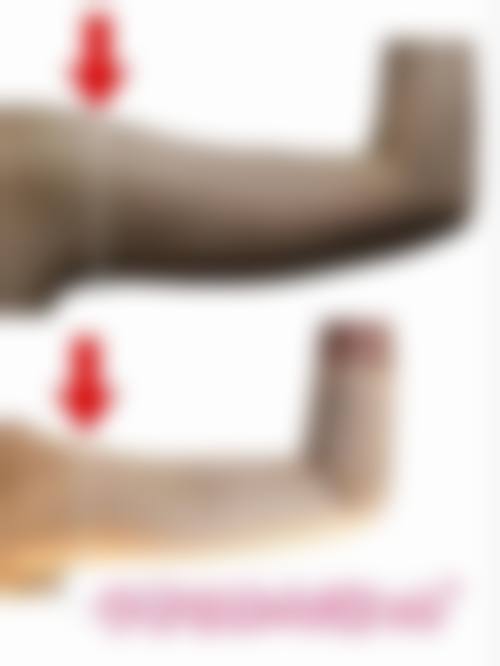 安心吸脂的成效稳定性与哪些条件直接相关