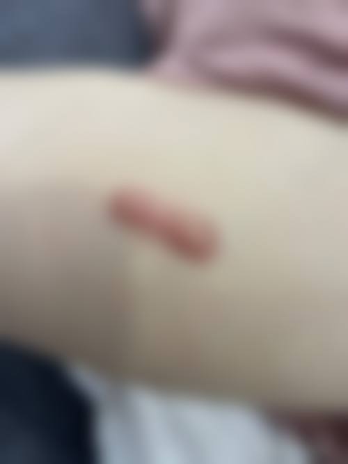 五、温岭臻美整形外科门诊部口碑评价