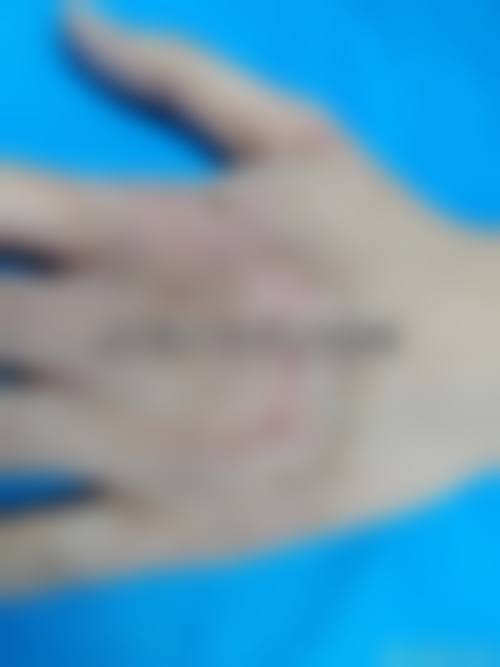 九江善善伊美整形医院价格表/收费区间参考