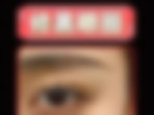 去眼袋后还有哪些有效的消肿方法？适度活动和热敷不可少