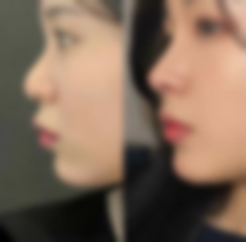 三、滁州美初医疗美容诊所开展项目