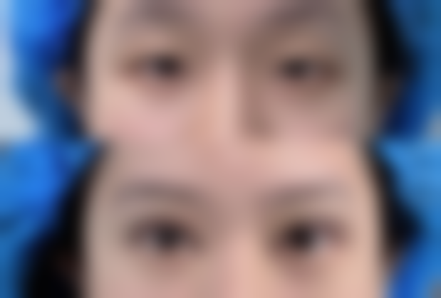 杭州悦可医疗美容诊所陈彩媛项目价格表？透明公开，性价比极高！