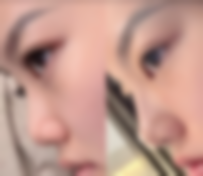 四、温岭臻美整形外科门诊部技术优势