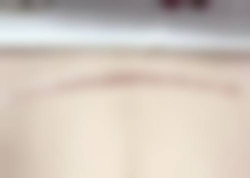 北京伊美尔爱康整形医疗美容医院口碑好不好？患者诊室评价