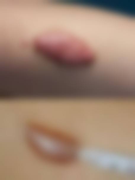 患者常见问题解答（精选 ）