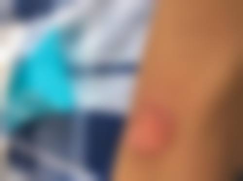 抚顺源泰医疗美容诊所重点开展项目