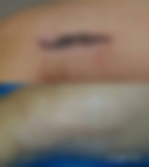 七、湖州丽尚丽医疗美容诊所常见问题解答