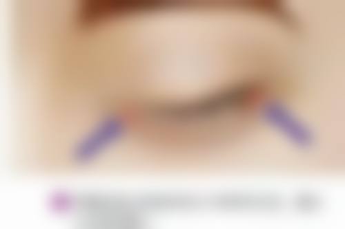 四、曼妮医生口碑评价好：