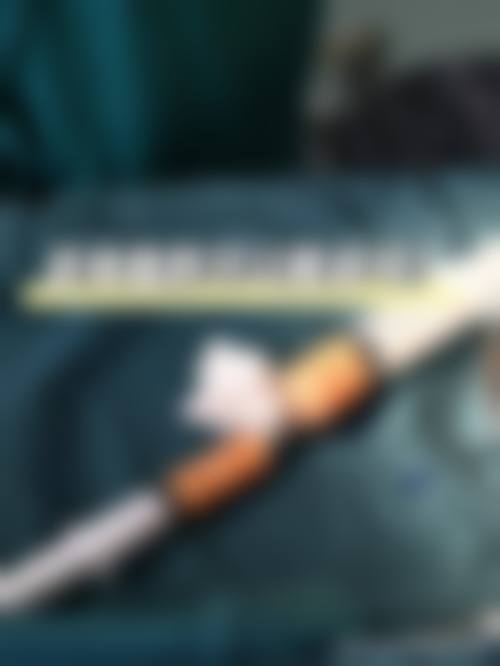 揭秘打针隆鼻热门材料