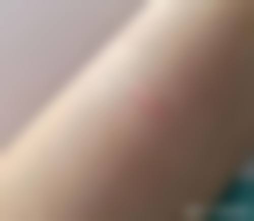 上海东方丽人医疗美容真实实例参考