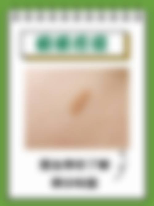 包皮手术后的疤痕会消失吗?多数可淡化!