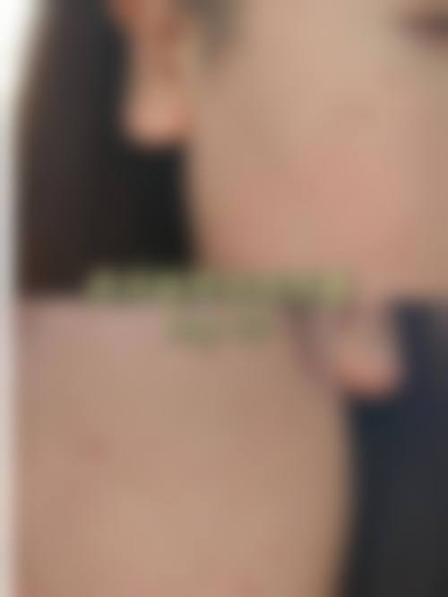 jf皮肤科收费价格表/收费标准