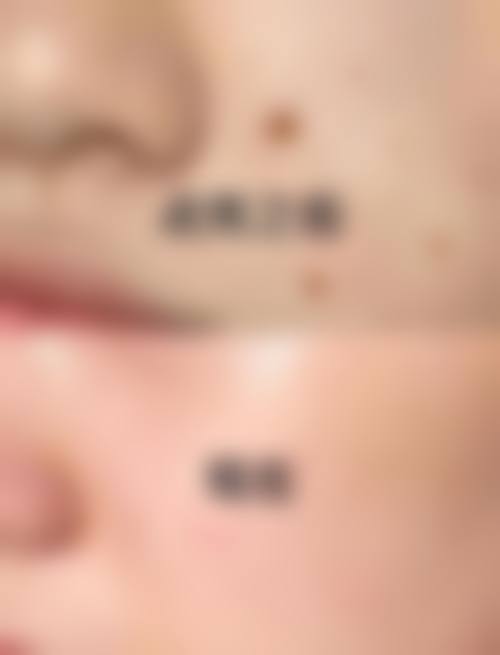 jf皮肤科口碑好不好？患者诊室评价