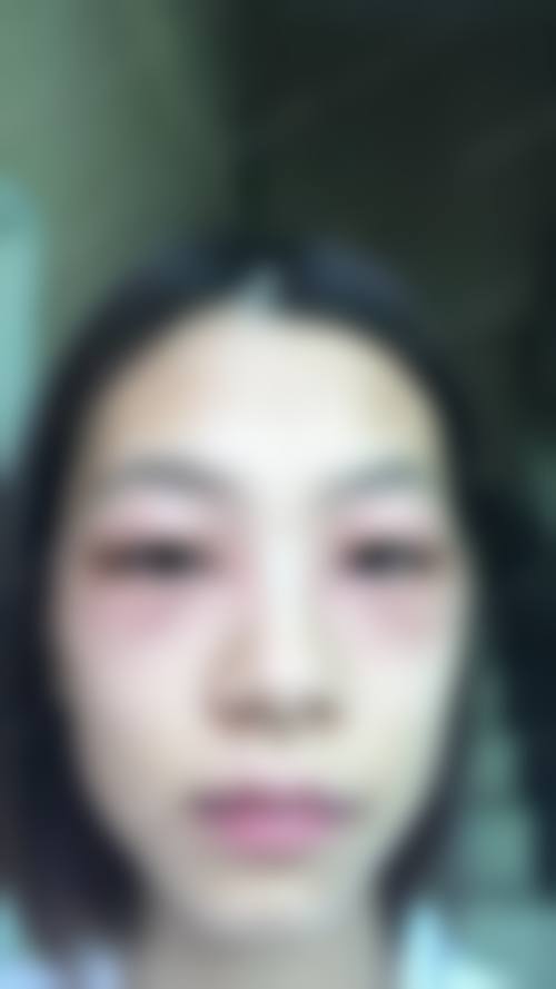 严重的眼袋怎么消？按摩+眼霜护理+充足睡眠，简单三步让你告别