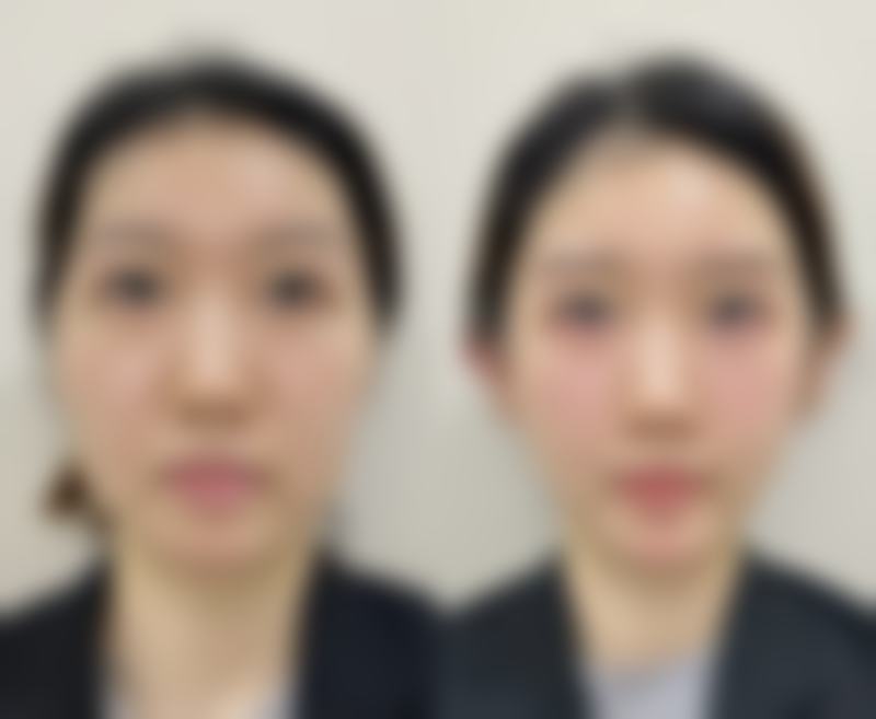 三、邱群英医生擅长项目与适合人群