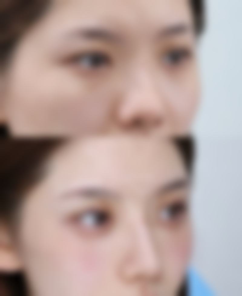 物理锻炼缩小阴唇的原理与成效