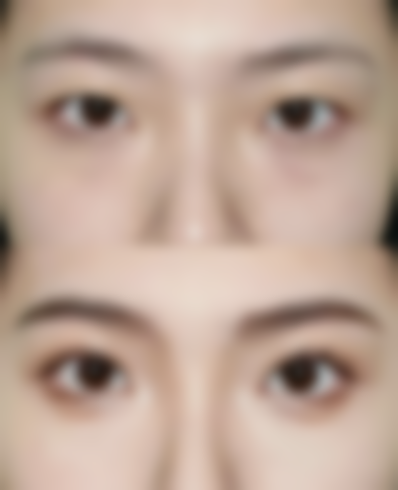 五、大同平城美神医疗美容诊所真实实例参考