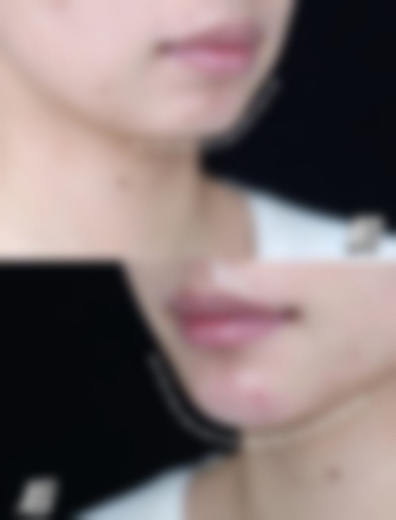 五、大连悦己整形医疗美容诊所价格表区间/收费标准说明