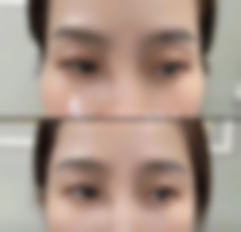 黄斑疤痕修复医院与医生选择中,哪些因素更关键?及医院医生推荐!