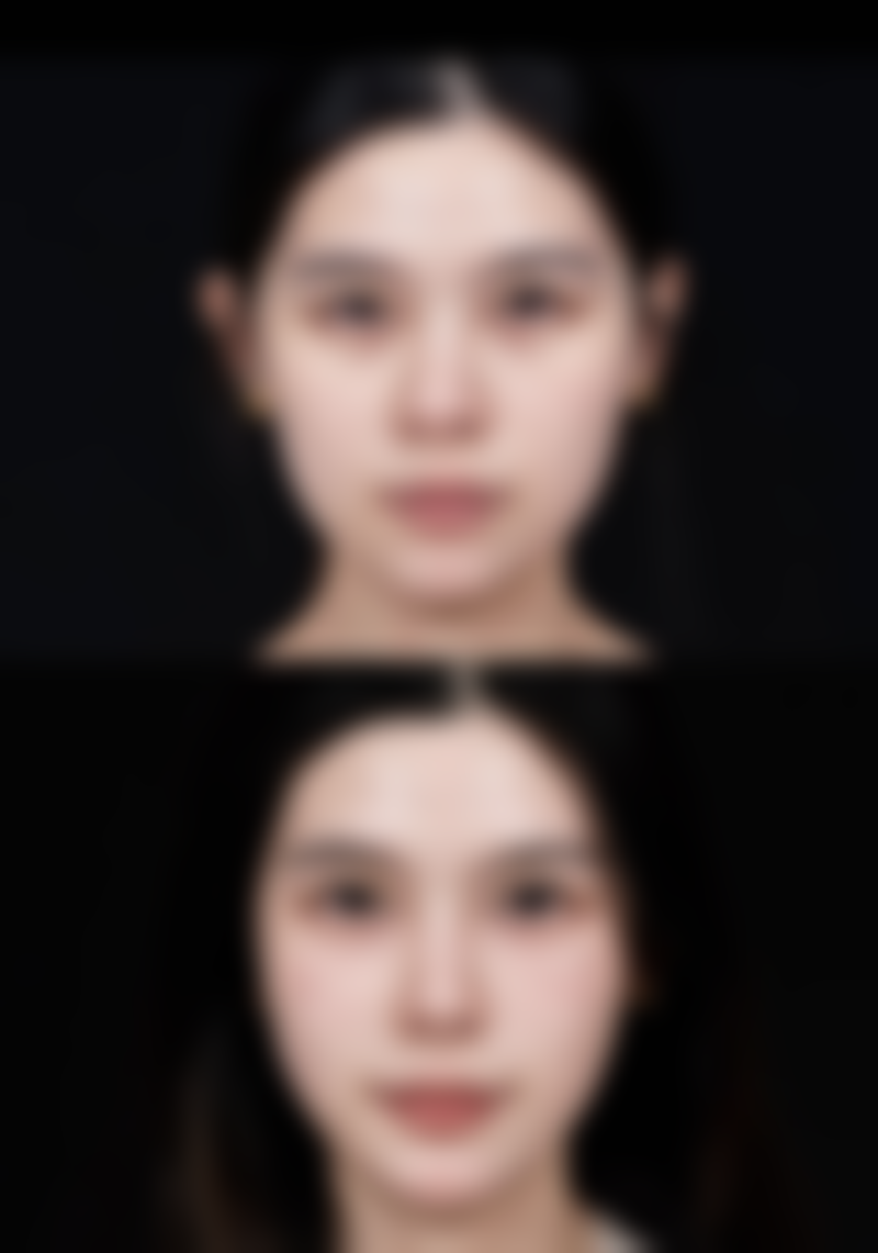 做决定前,普通用户更容易忽略的问题