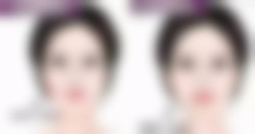 阴道紧缩术成效明显吗？受多种因素制约！