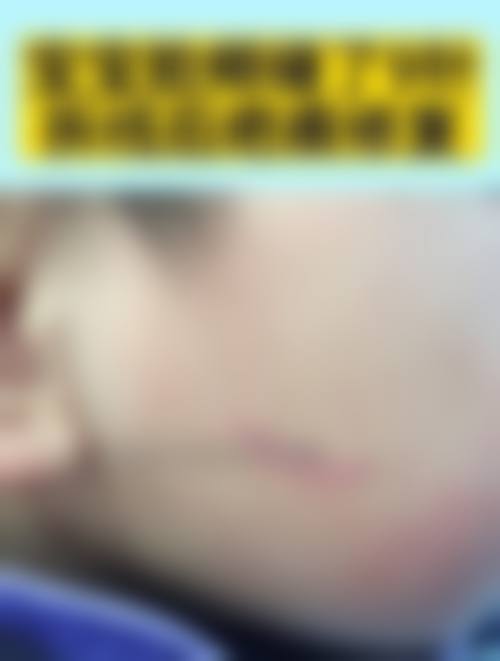 上海哪些医院和医生擅长小女孩额头疤痕修复？口碑推荐来啦！