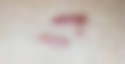 患者常见问题解答（精选 ）