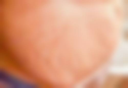 三、从医学角度看，疤痕妊娠继续妊娠的核心目的是什么？