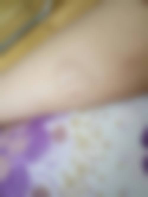 深圳思羽医疗美容门诊部患者常见问题解答(精选 )