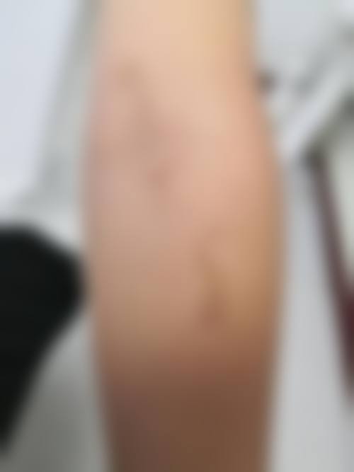 患者常见问题解答（精选 ）