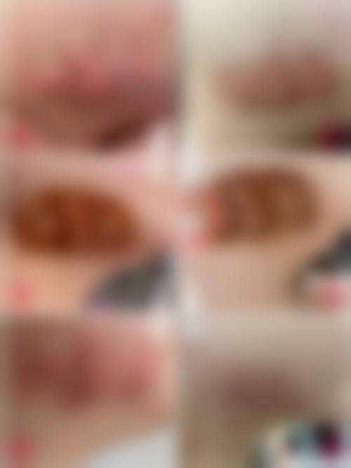 疤痕修复的价格区间及费用差异来源