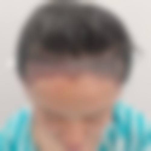 南京熙宸整形医疗美容门诊部真实实例参考