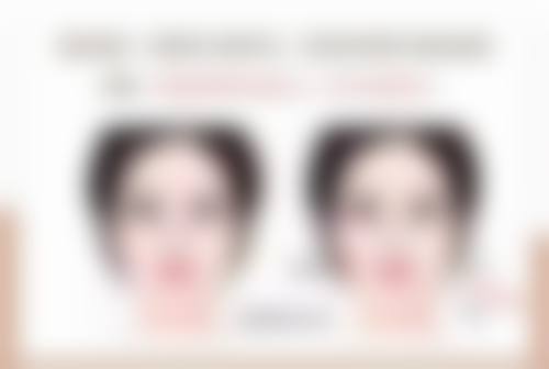 瘦脸针注射一针能维持多长时间？揭秘3 - 6个月时长背后个人代谢等因素影响！ 