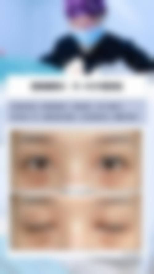 按摩加眼霜去除眼袋常见并发症或后遗问题,在临床中如何理解其发生概率?