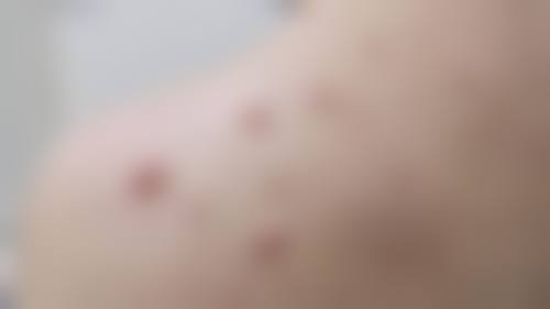 烟台兰积驻颜整形医院口碑好不好？患者诊室评价