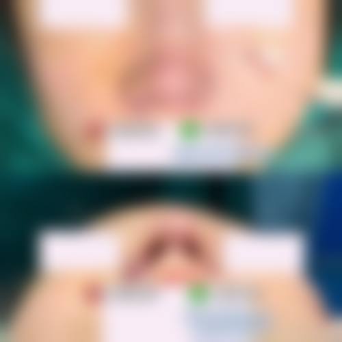 患者常见问题解答(精选 )