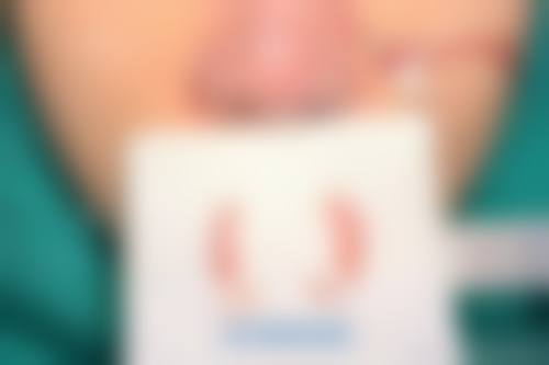 隆鼻技术或材料本身的优势与局限