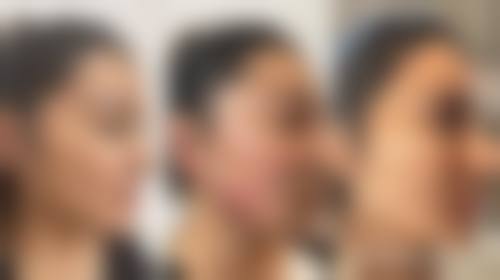 河南大学附属南石医院烧伤整形美容中 心重点诊疗项目及技术优势