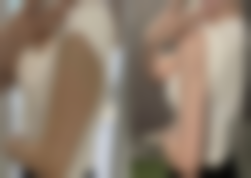 青岛瑧妍美口碑评价：患者真实反馈参考