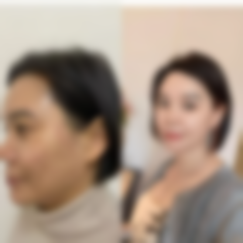 敷眼膜对消除眼袋的作用