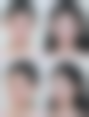 去除眼袋手术治疗或手术成效通常能维持多久?常见变化路径