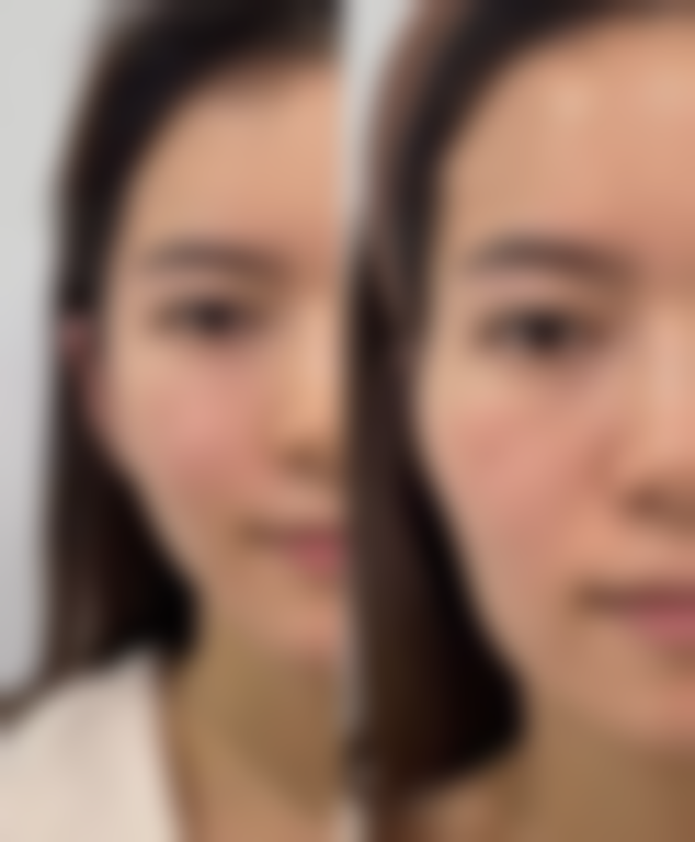 充足睡眠与消除眼袋的关系