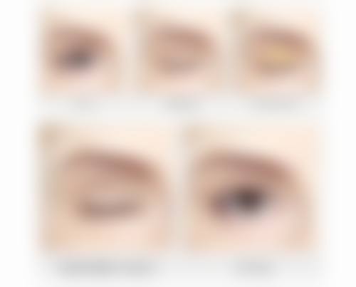 赵灿灿医生真皮微创 3D 束带术特色技术怎么样