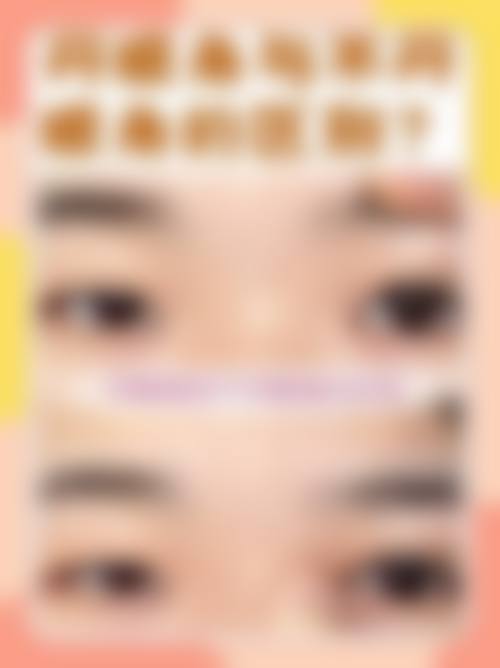 双眼皮手术的失败结果是否存在不可逆情况