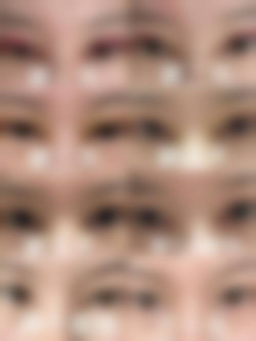 哪些人群做双眼皮手术时失败风险相对更高