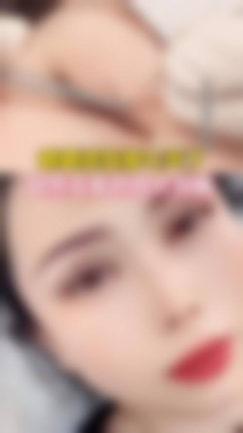 手术成效揭秘：熬夜眼袋去除后会怎样？