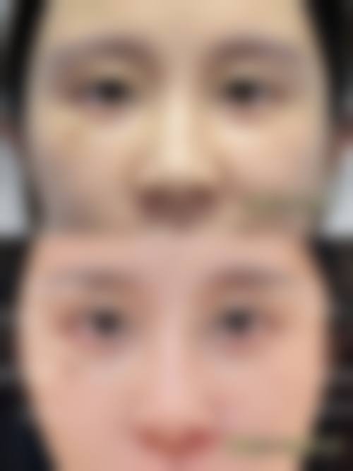 深圳美客华美整形美容医院口碑好评反馈