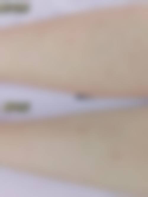 商丘城乡一体化示范区颜小柒医疗美容诊所口碑好不好?患者诊室评价: