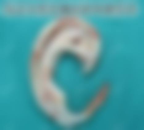 韩国普瑞美整形外科真实实例参考