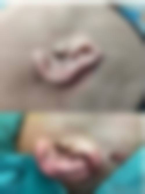 韩国普瑞美整形外科重点开展项目